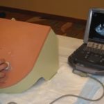 Ultrasound Guided Paracentesis