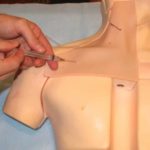 Subclavian Line Placement