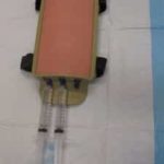 Ultrasound Guided Peripheral IV