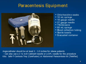 paracentesis equipment