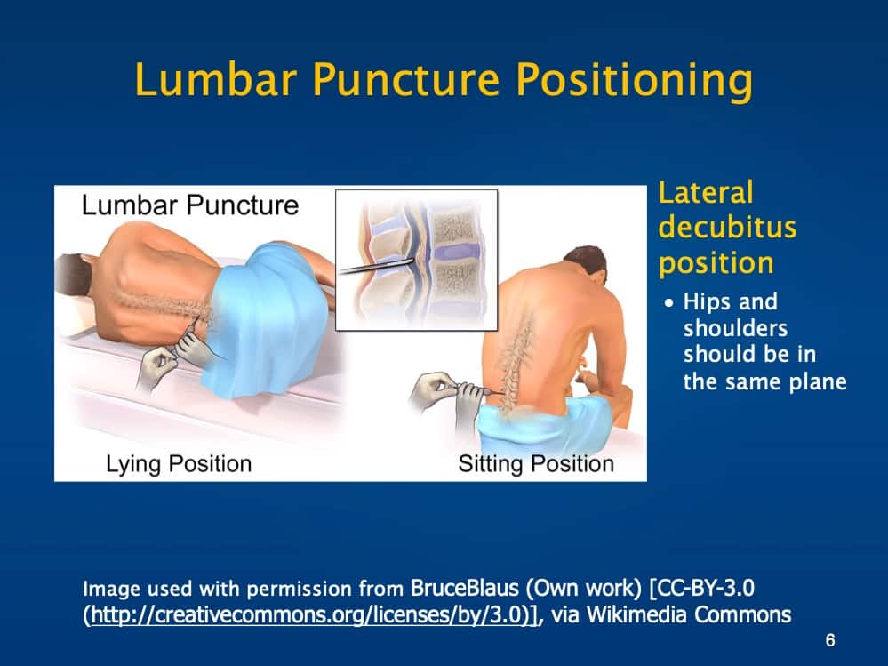 Lumbar Puncture Course Hospital Procedures Consultants