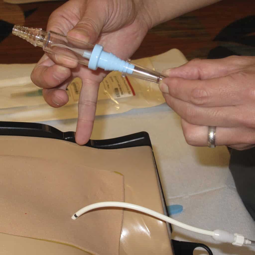 Step 8: Wire-Guided Pigtail Catheter Placement