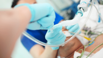 What Causes Difficult Intubation