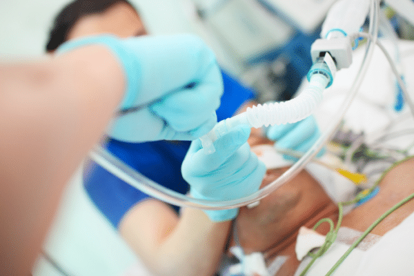 What Causes Difficult Intubation